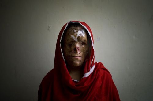 Pakistan Domestic Violence